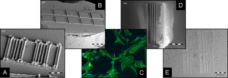 Microstructure